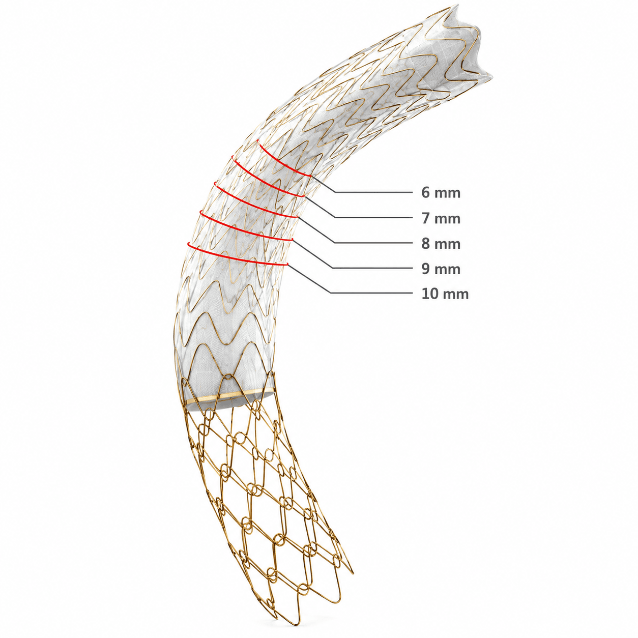 Image of TIPS stent-graft
